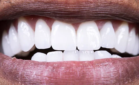 Here's what to eat to protect your mouth's good bacteria