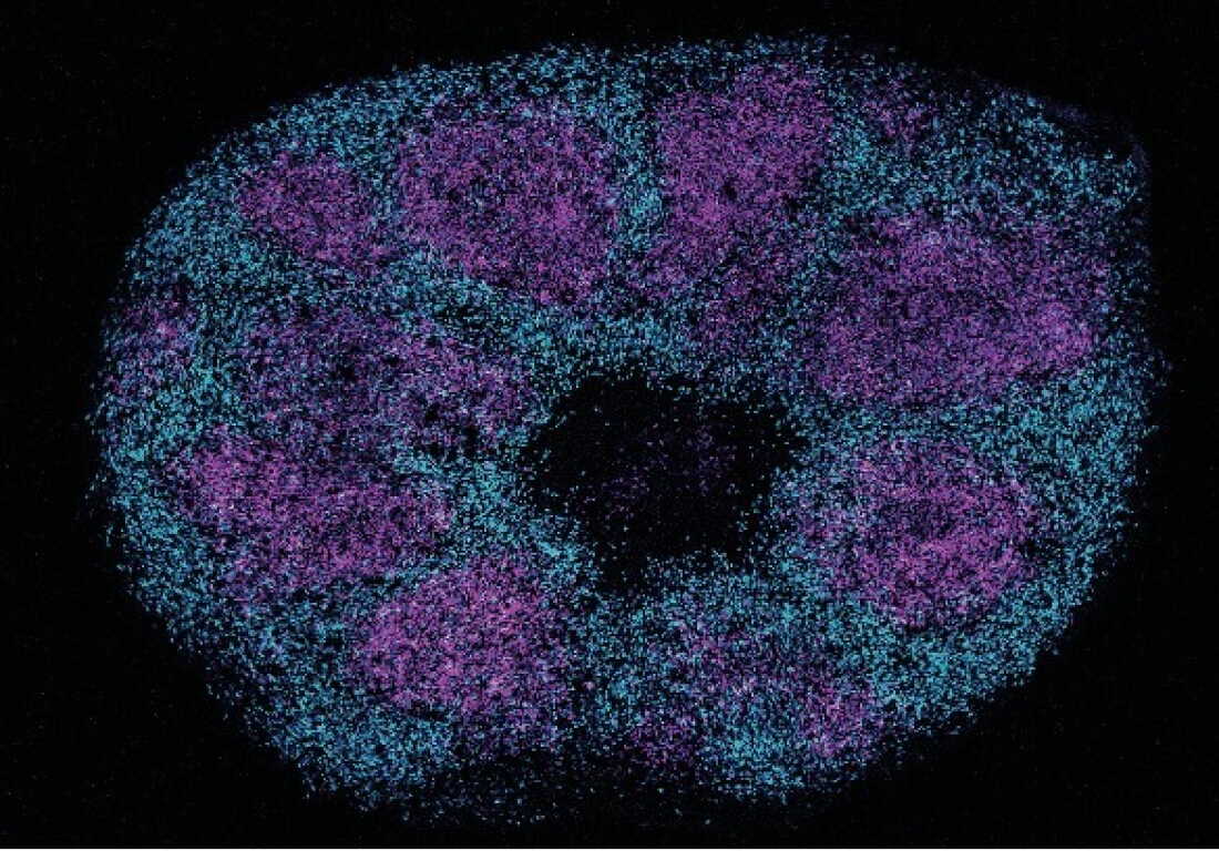 Scientists map key protein interactions linked with profound autism