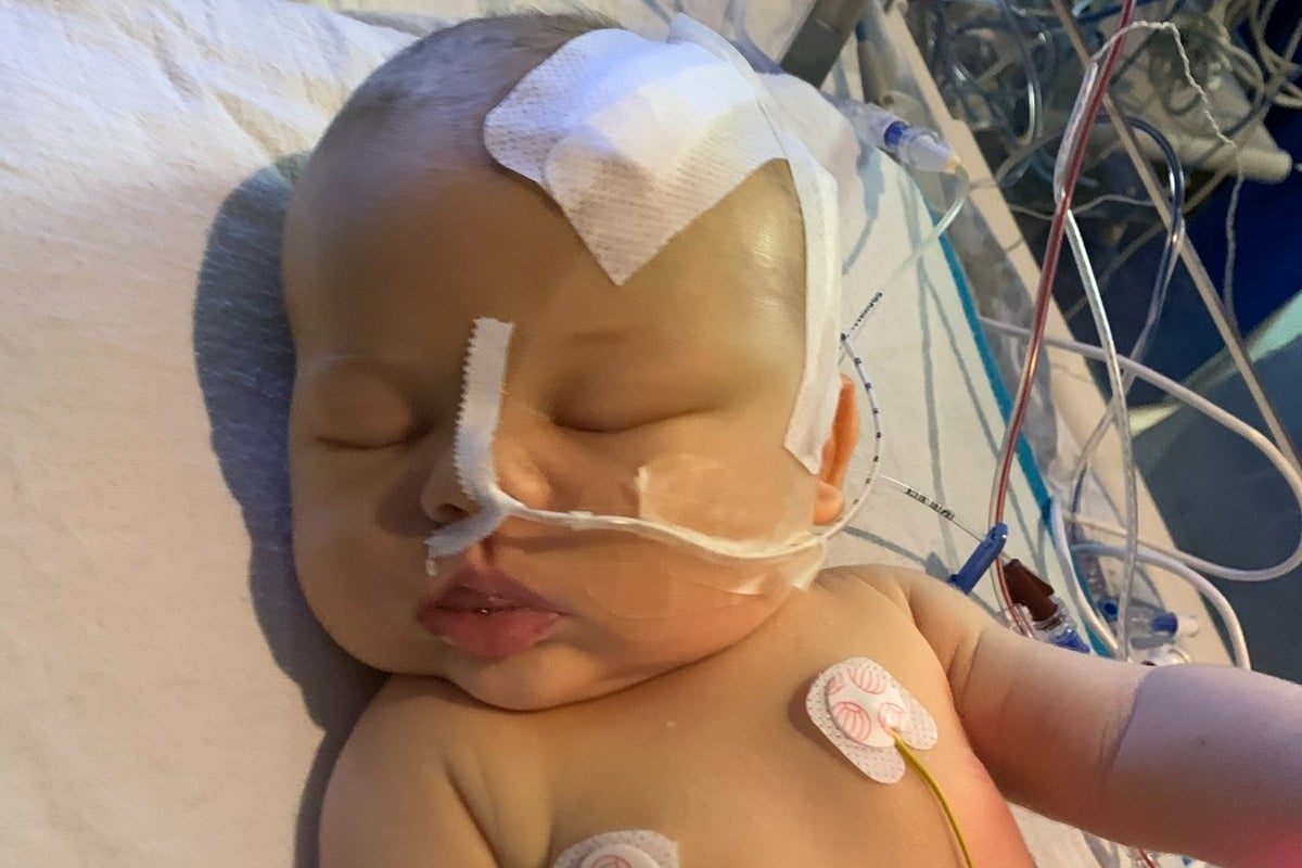 Newborn diagnosed with brain tumour after doctors spot tiny detail on fingernail