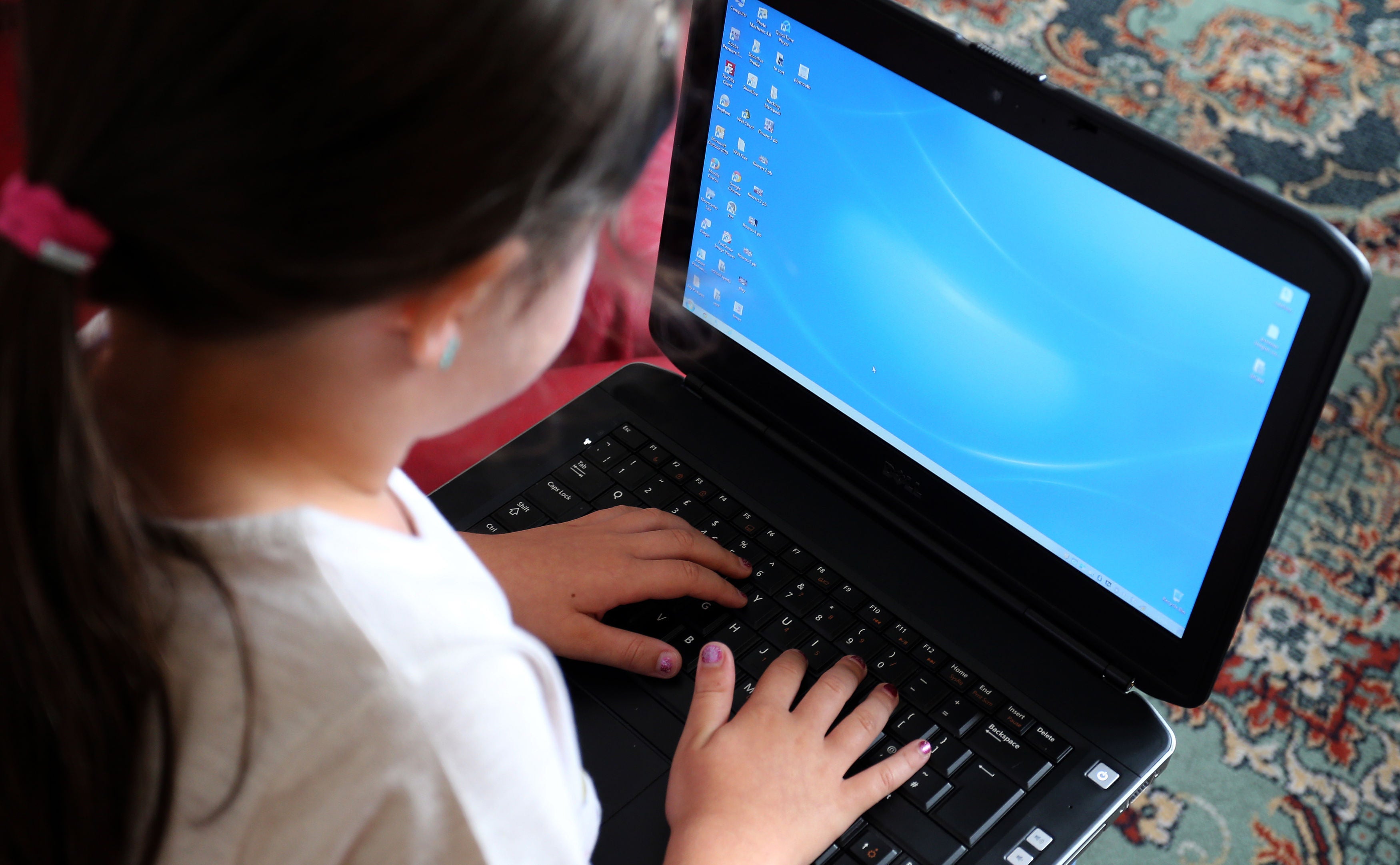 Toasted skin syndrome: The condition linked to devices on the rise among children