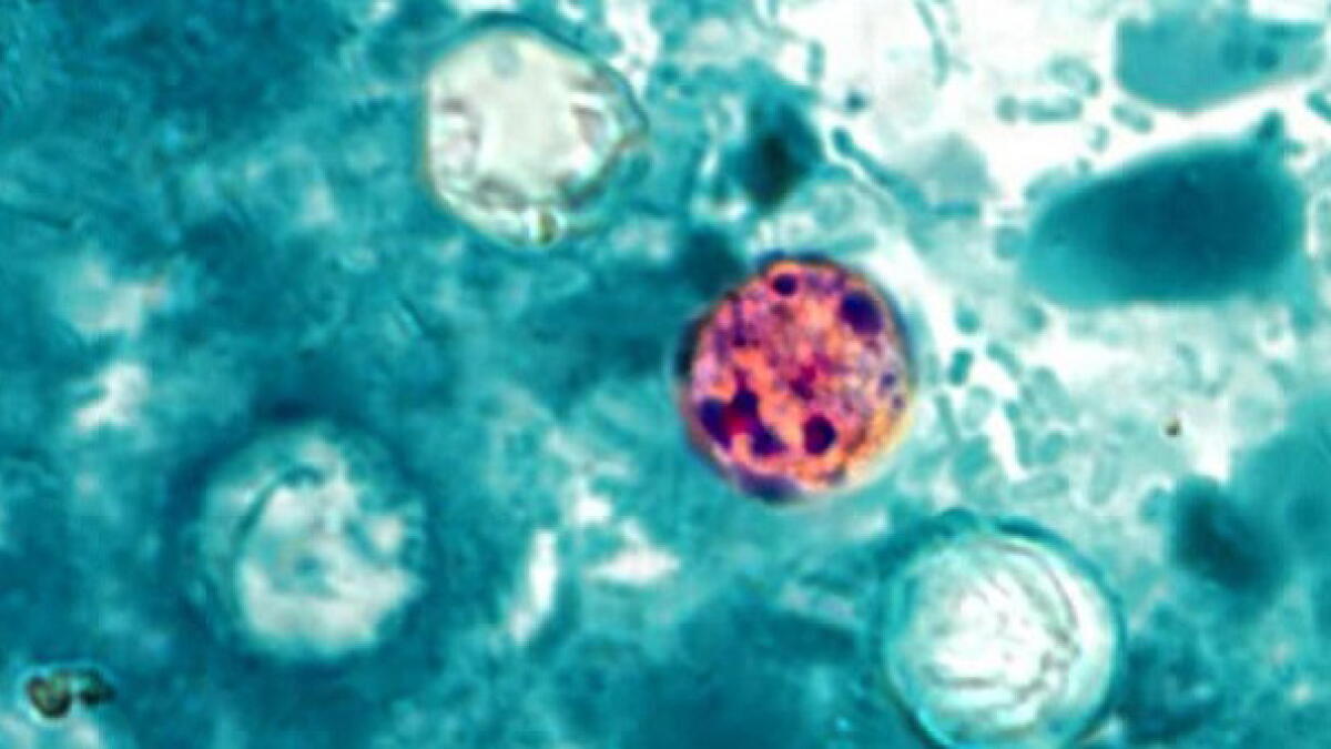 Cyclosporiasis outbreak that sickened tens of thousands officially over, CDC says