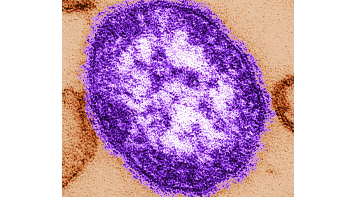 Pennsylvania officials report state’s 3rd death involving measles