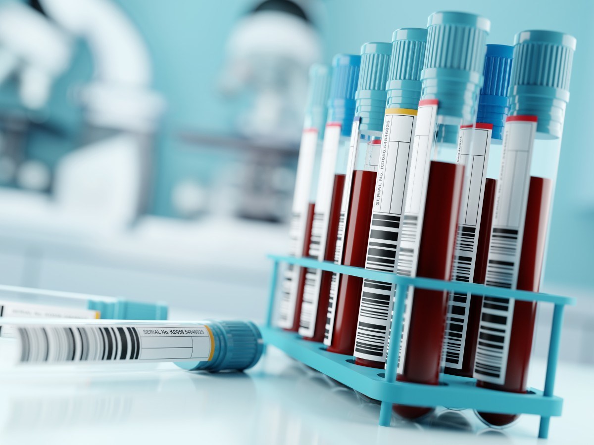 Scientists may have found a way to predict when Alzheimer's symptoms will begin
