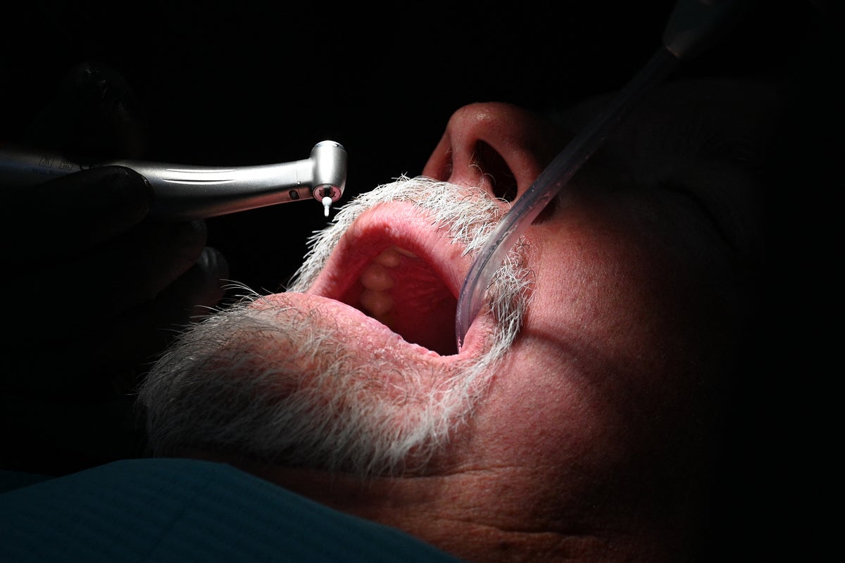 The oral condition that increases sdementia risk by over 50 per cent