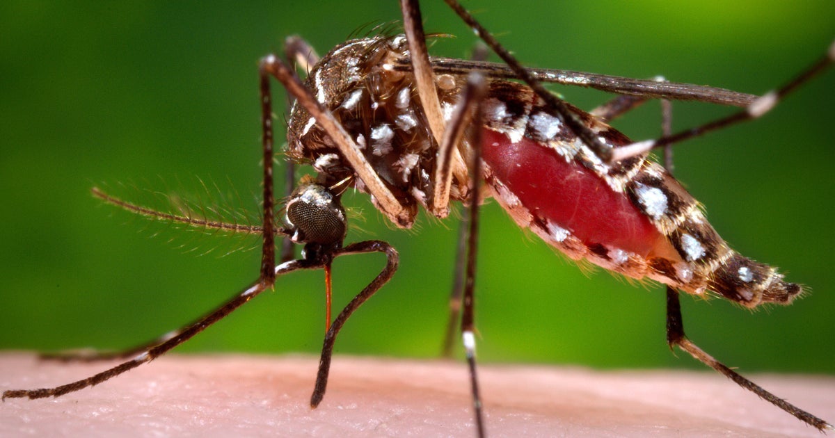 Elderly Tampa woman dies amid Florida's second-worst dengue outbreak on record, health officials say