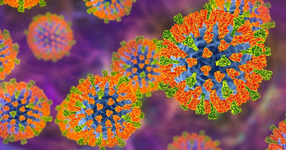 Possible measles exposure reported at Philadelphia International Airport not related to CHOP case
