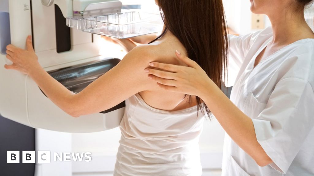 Breast cancer NHS trust to review 4,500 more cases