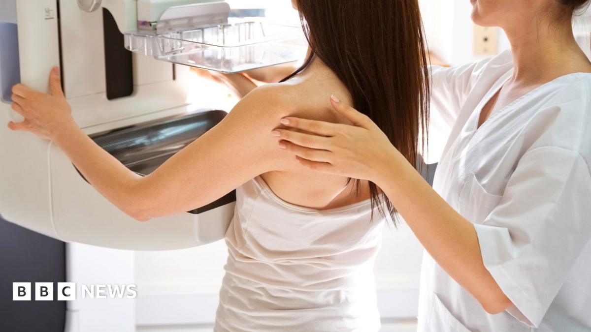 Breast cancer NHS trust to review 4,500 more cases