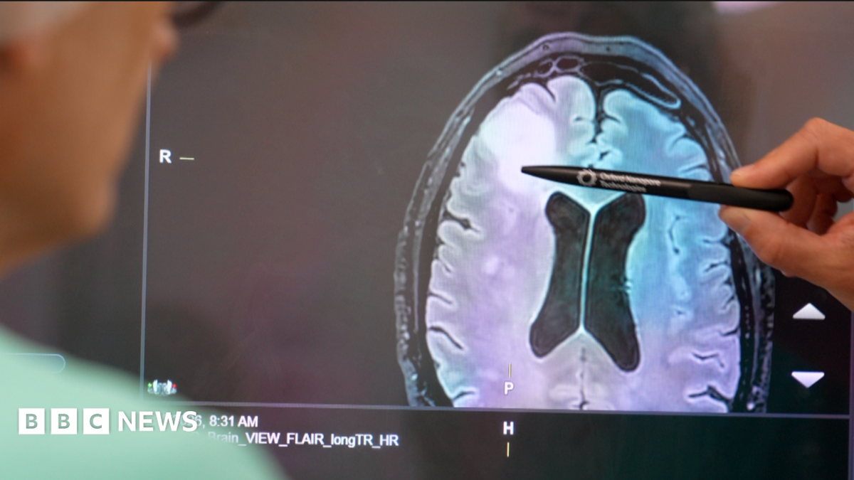 Newcastle rolls out 'revolutionary' brain tumour diagnosis test