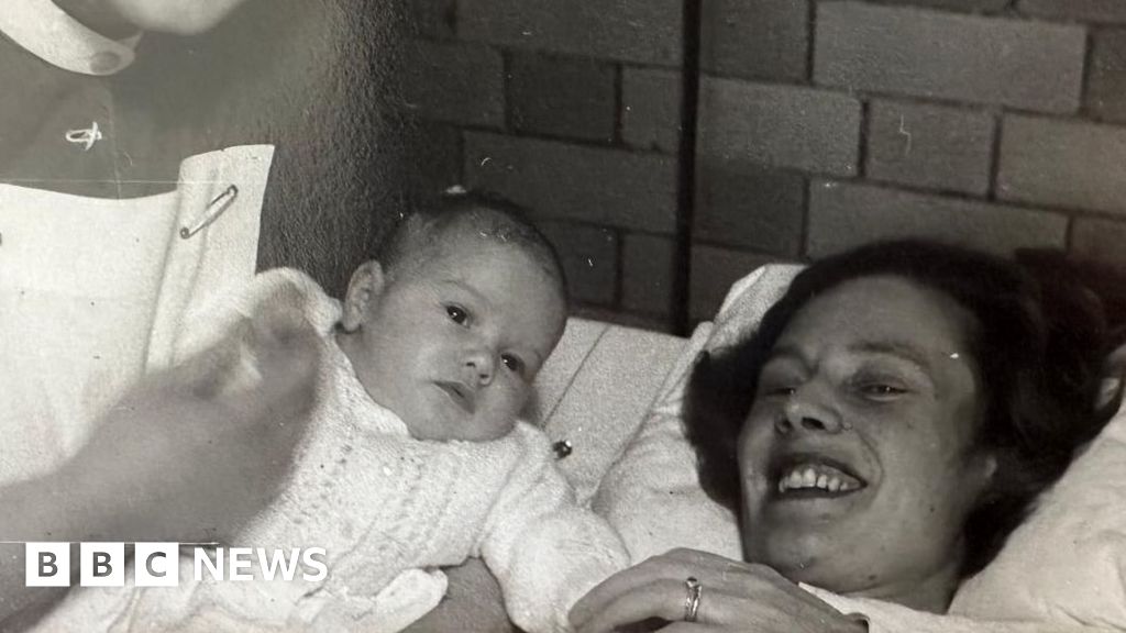 'I was born while my mother was in an iron lung'