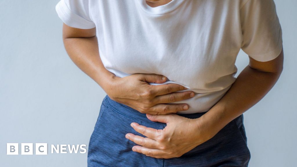 Bowel cancer screening programme expanded in Northern Ireland