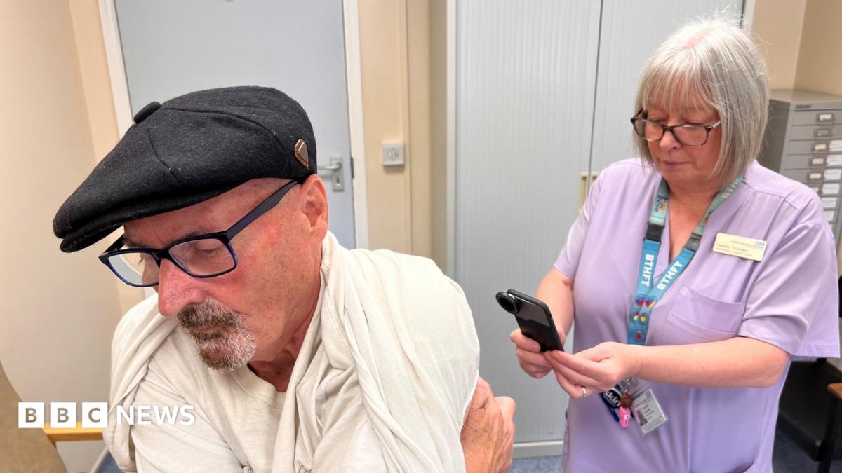 Bradford skin cancer waiting times cut by new AI technology