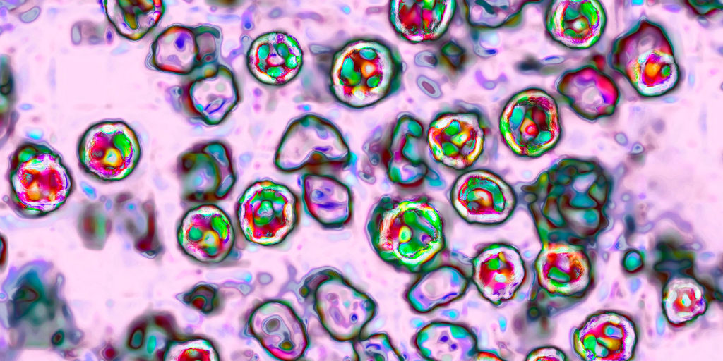Pennsylvania’s measles outbreak is the country’s largest in three decades