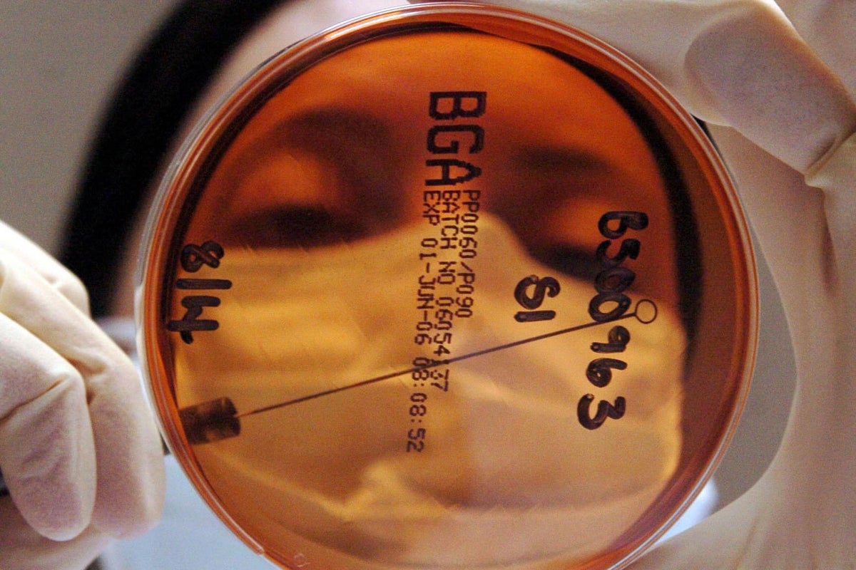 Scientists discover the likely cause of one in eight cancers worldwide