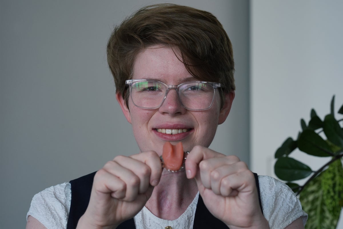 Artificial tongue helps cancer survivor to speak again in NHS first