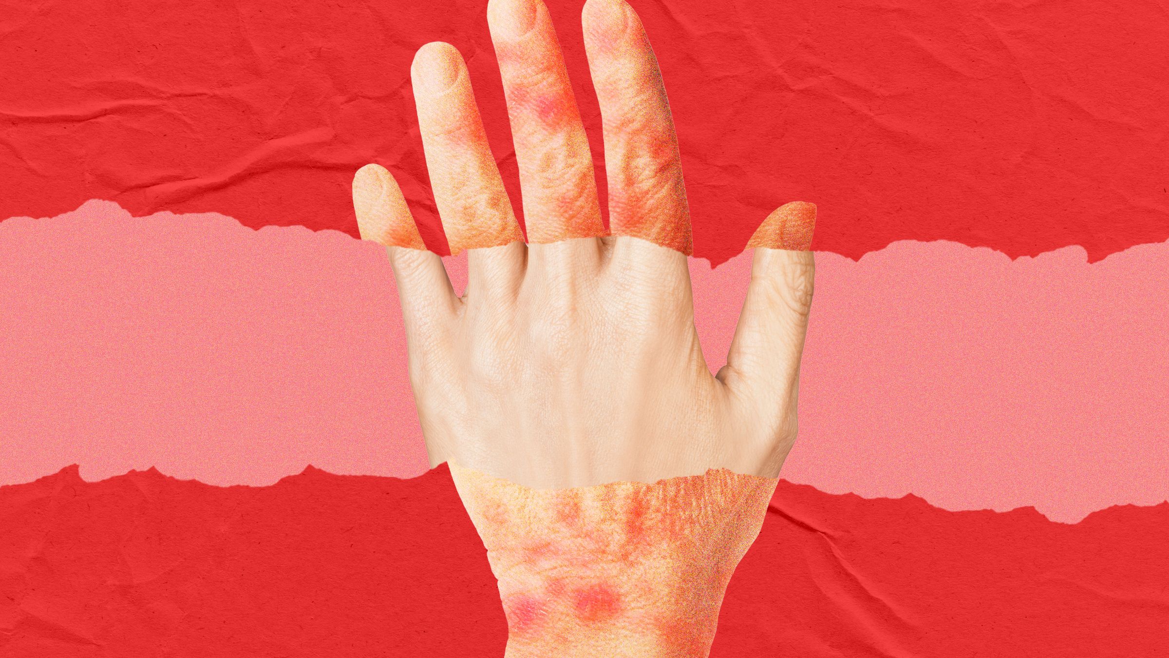 A New Anti-Aging Drug Looks to Turn Back the Clock on Skin Age