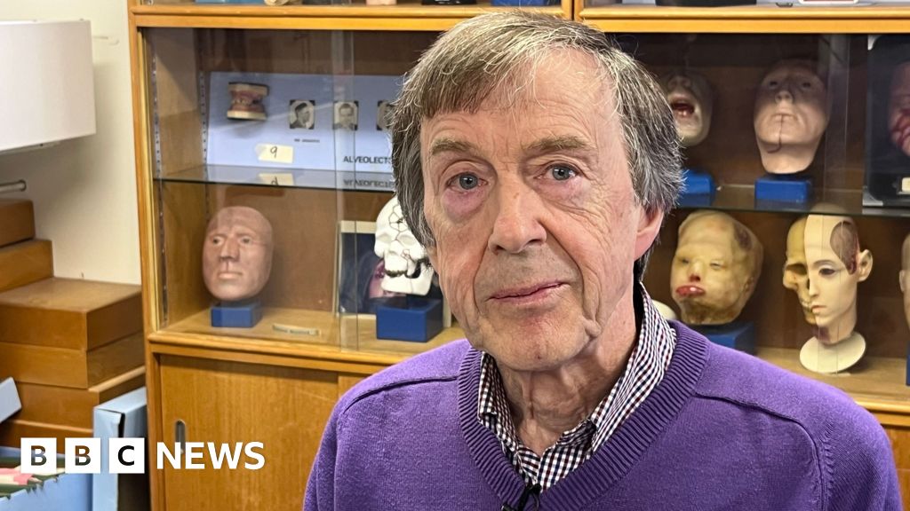 'I could never hear on my left side - until I got a prosthetic ear'