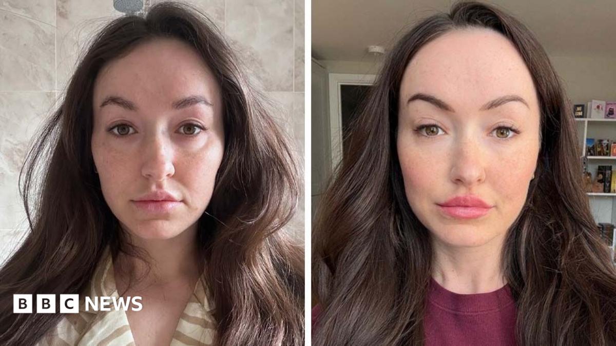 Is 'ferritin face' a real thing - and can you really spot low iron from looks?