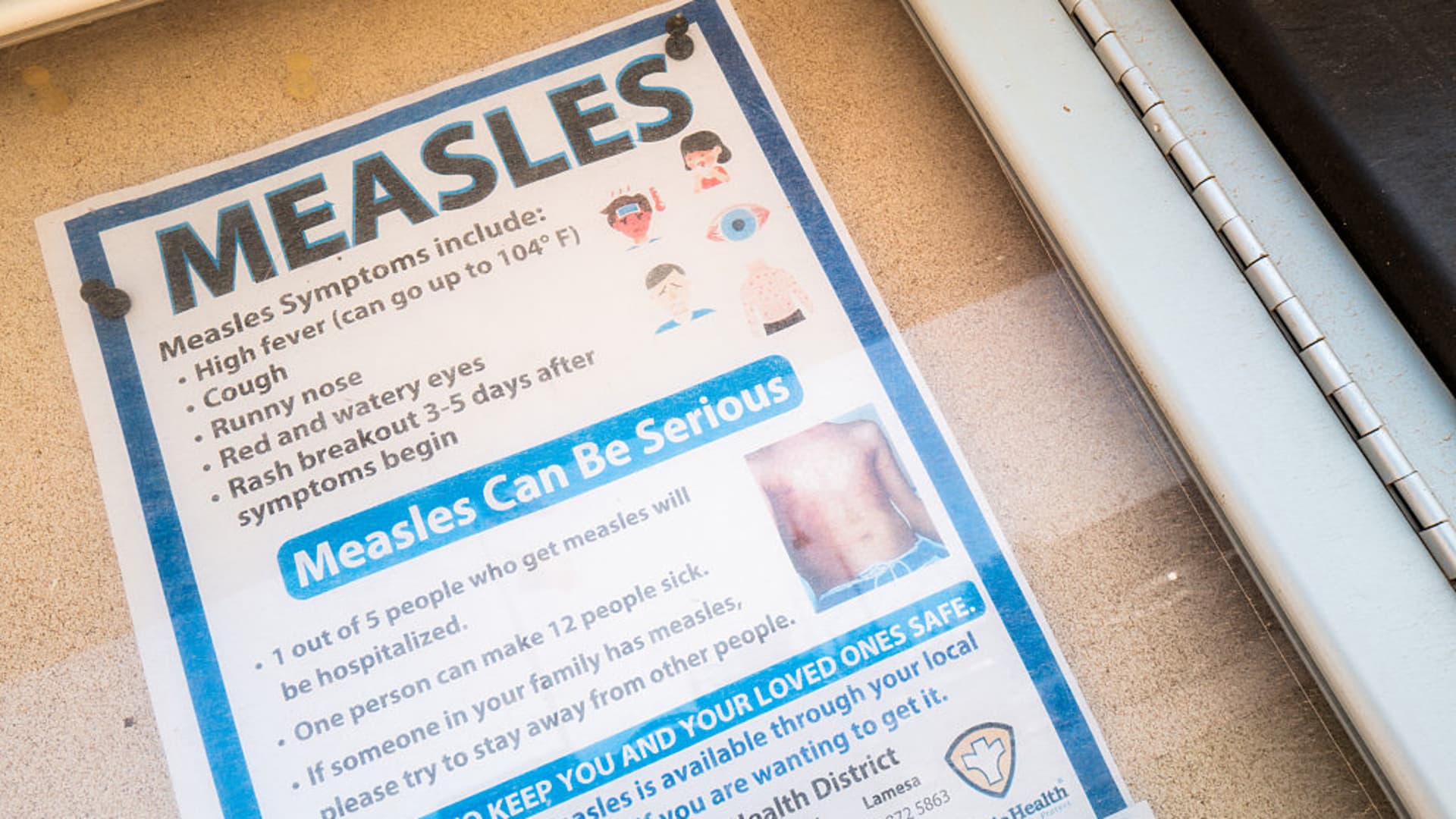 A 'canary in the coal mine': Measles resurgence exposes weaknesses in U.S. public health, experts say