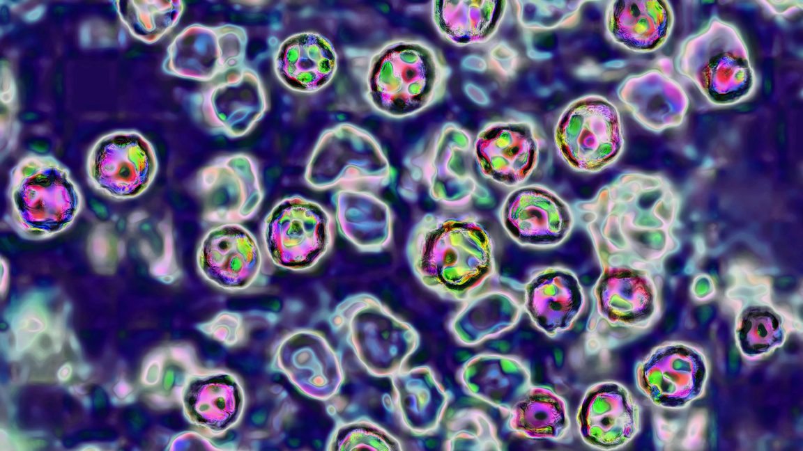 Domestic travel poses growing risk for measles—and a new challenge for states