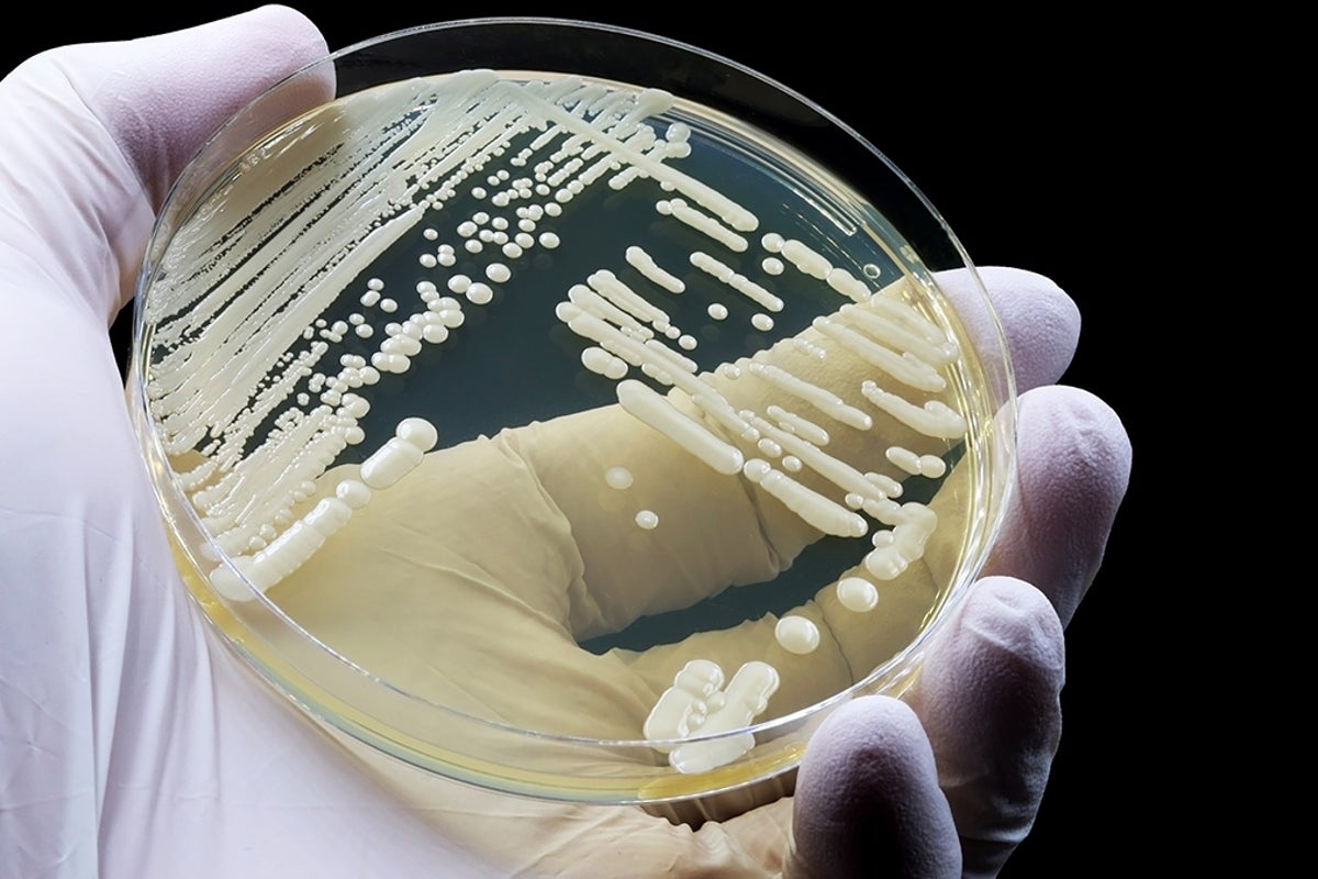 These are the 4 most urgent superbugs spreading in the US this winter